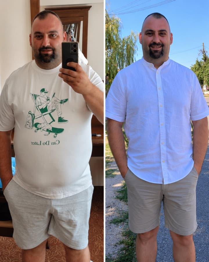 Dany before and after losing 31 kg