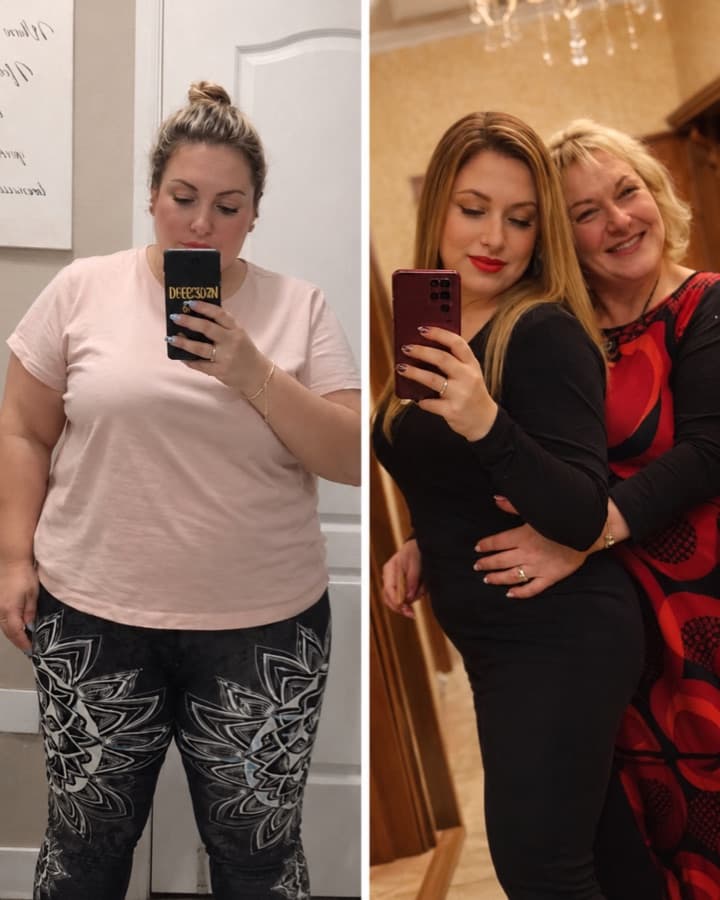 Mihaela before and after losing 23 kg
