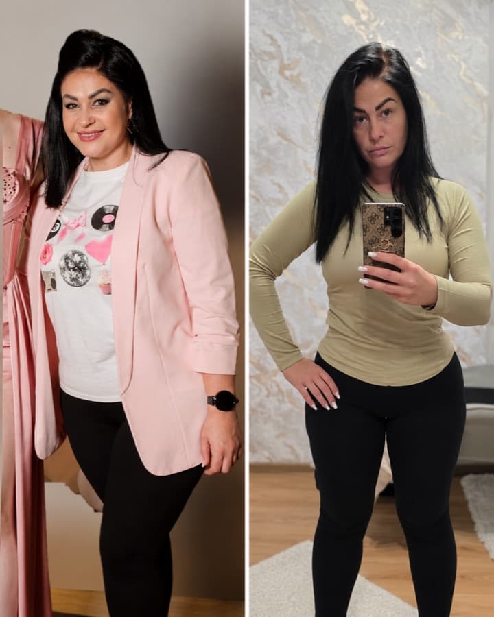 Client before and after losing 14 kg