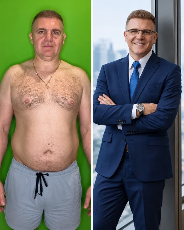 Client before and after losing 24 kg