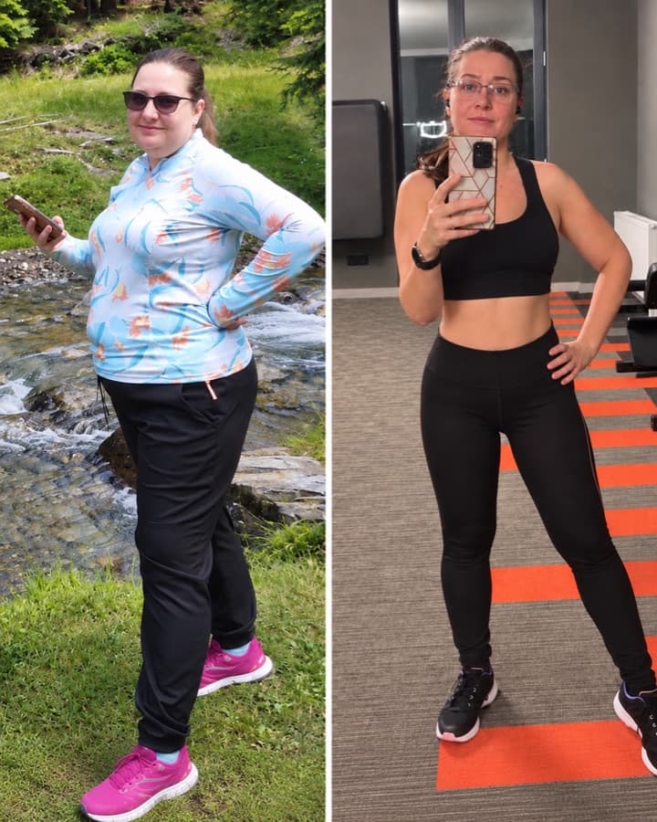 Oana before and after losing 47 kg