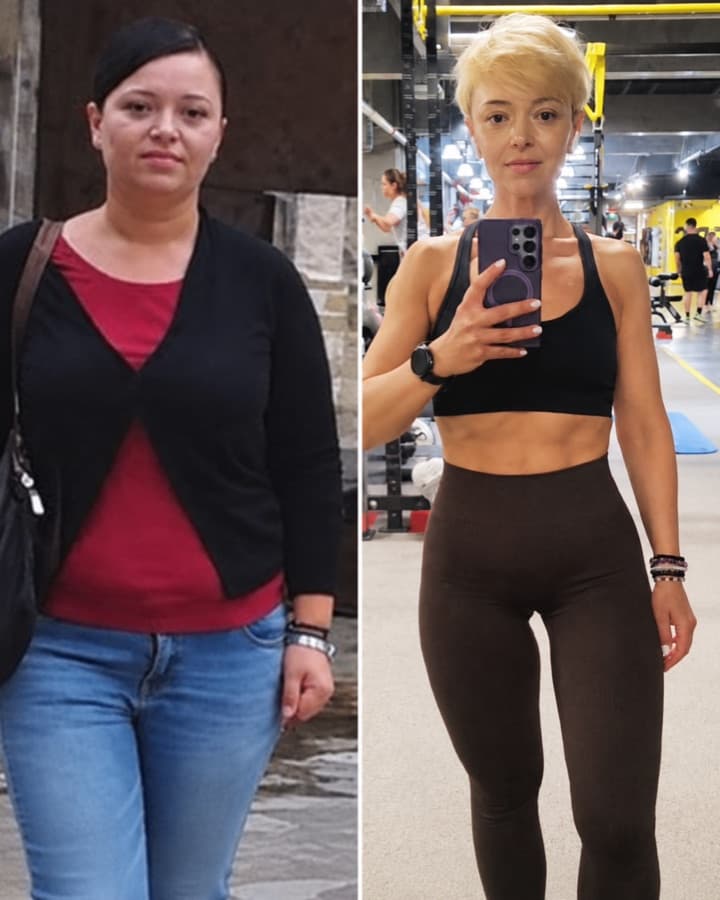 Violeta before and after losing 39 kg
